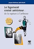 Ligament Croise Anterieur
