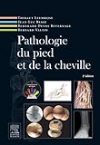 Pathologie Du Pied Et De La Cheville