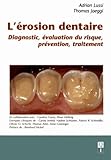Lrosion Dentaire Diagnostic Valuation Du Risque Prvention Traitement