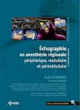 Chographie En Anesthsie Rgionale Priphrique Mdullaire Et Primdullaire