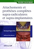 Attachements Et Prothses Compltes Supraradiculaires Et Supraimplantaires