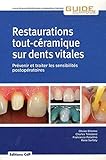 Restaurations Toutcramique Sur Dents Vitales Prvenir Et Traiter Les Sensibilits Postopratoires