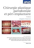 Chirurgie Plastique Parodontale Et Priimplantaire