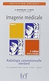 Imagerie M%C3%A9dicale : Radiologie Conventionnelle Standard   Tome 1, 3%C3%A8me %C3%A9dition