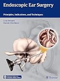 Endoscopic Ear Surgery Principles Indications And Techniques