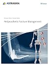Periprosthetic fracture management