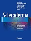 Scleroderma From Pathogenesis To Comprehensive Management