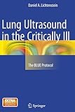 Lung Ultrasound In The Critically Ill The Blue Protocol