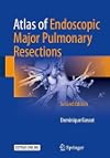 Atlas of endoscopic major pulmonary resections