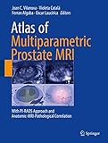 Atlas Of Multiparametric Prostate Mri With Pirads Approach And Anatomicmripathological Correlation