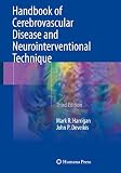 Handbook Of Cerebrovascular Disease And Neurointerventional Technique Contemporary Medical Imaging