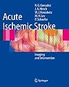 Acute Ischemic Stroke: Imaging and Intervention