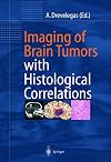 Imaging of Brain Tumors with Histological Correlations