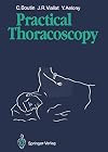 Practical Thoracoscopy