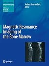 Magnetic resonance imaging of the bone marrow