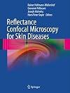 Reflectance Confocal Microscopy for Skin Diseases