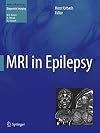 MRI in Epilepsy (Medical Radiology / Diagnostic Imaging)