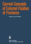 Current concepts of external fixation of fractures