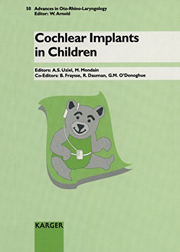 Cover of Cochlear implants in children