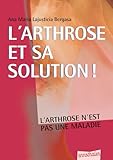 L'arthrose Et Sa Solution !