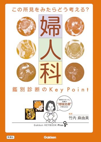 この所見をみたらどう考える? 婦人科 鑑別診断のKey Point