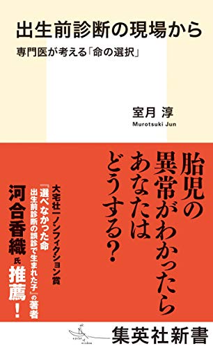 出生前診断の現場から 専門医が考える「命の選択」