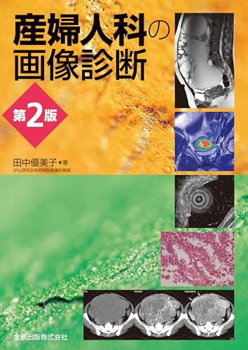 産婦人科の画像診断 第2版