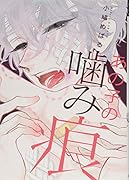 あの子の噛み痕