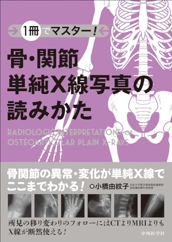 1冊でマスター! 骨・関節単純X線写真の読みかた