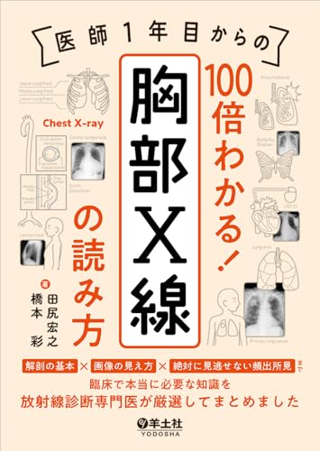 医師1年目からの 100倍わかる!胸部X線の読み方
