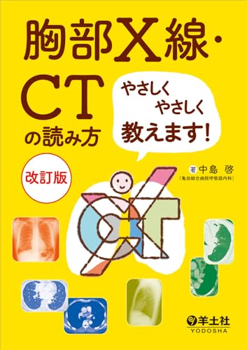 胸部X線・CTの読み方やさしくやさしく教えます! 改訂版