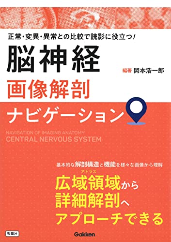 脳神経画像解剖ナビゲーション