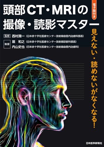 頭部CT・MRIの撮像・読影マスター