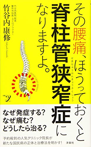 その腰痛、ほうっておくと脊柱管狭窄症になりますよ。