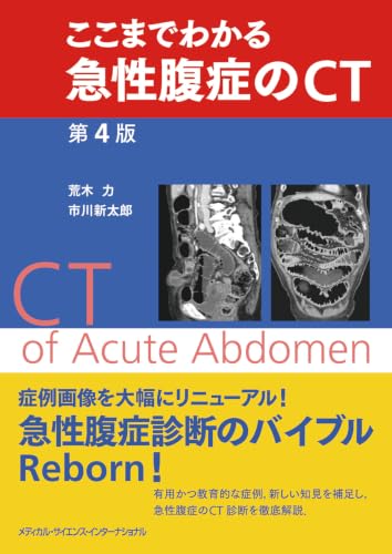ここまでわかる急性腹症のCT 第4版
