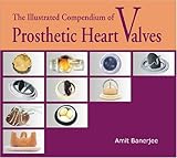 The Illustrated Compendium Of Prosthetic Heart Valves