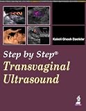 Transvaginal Ultrasound