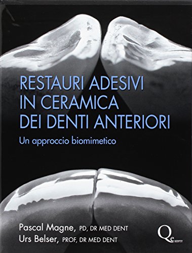 Copertina: Restauri adesivi in ceramica dei denti anteriori