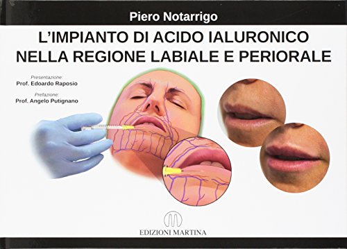Copertina: L’IMPIANTO DI ACIDO IALURONICO NELLA REGIONE LABIALE E PERIORALE