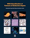 Who Classification Of Tumours Of Endocrine Organs Medicine