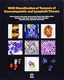 Who Classification Of Tumours Of Haematopoietic And Lymphoid Tissues