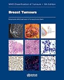 Defaultset Breast Tumours Who Classification Of Tumours Medicine