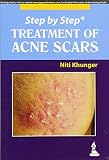 Step By Step Treatment Of Acne Scars