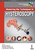 Mastering The Techniques In Hysteroscopy