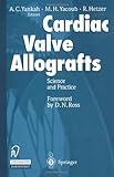 Cardiac Valve Allografts Science And Practice English Edition