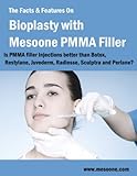 The Facts Features On Bioplasty With Mesoone Pmma Filler Is Pmma Filler Injection Better Than Botox Restylane Juvederm English Edition