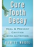 Cure Tooth Decay Heal And Prevent Cavities With Nutrition Limit And Avoid Dental Surgery And Fluoride Second Edition 5 Stars English Edition