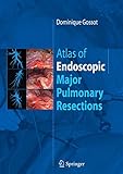 Atlas Of Endoscopic Major Pulmonary Resections English Edition