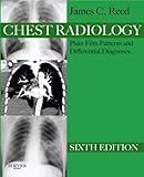 Chest Radiology Plain Film Patterns And Differential Diagnoses Ebook Expert Consult Title Online Print English Edition