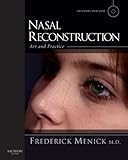 Nasal Reconstruction Art And Practice English Edition